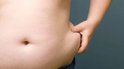 Obesitas - wisworkcompexperts.com