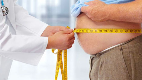 Obesitas - citraindonesia.com