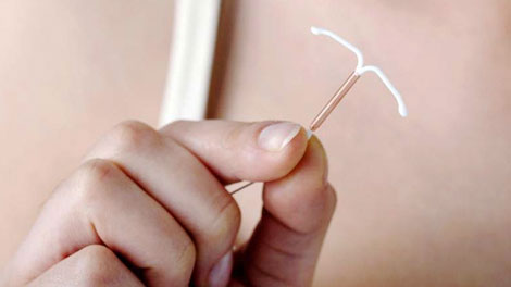 Pasang IUD (Kontrasepsi) - www.elawoman.com