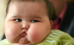 Anak-Obesitas