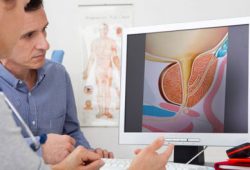 Tips Simpel Atasi Gejala Pembesaran Prostat