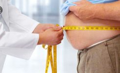 Obesitas