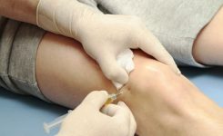 Operasi-Penggantian-Sendi-L