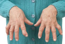 Konsumsi Ikan Meringankan Rheumatoid Arthritis?