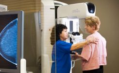 Screening-Mammogram