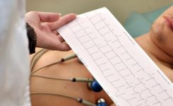 Tes-Electrocardiogram