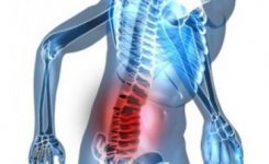 kanker tulang belakang