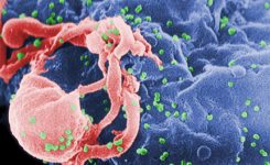 virus-HIV